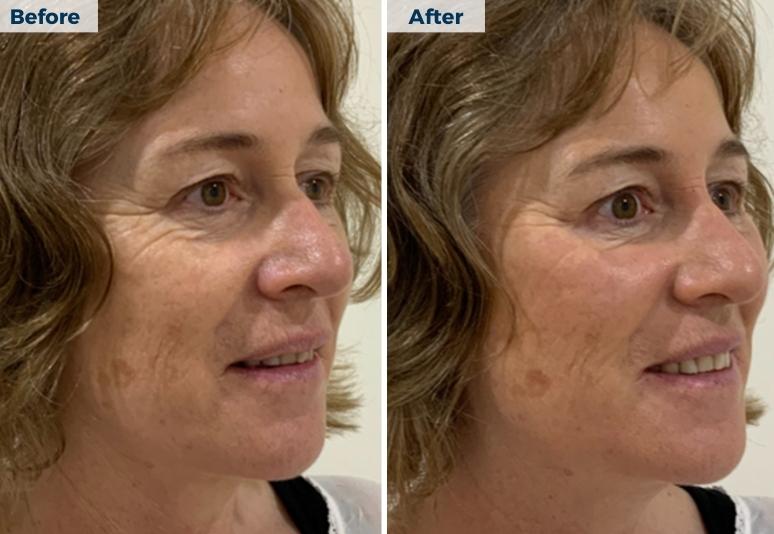 Skin Repair Skin Cancer Centre in Townsville, Queensland